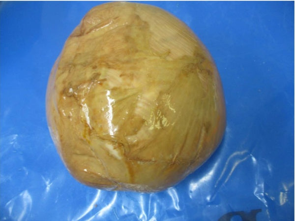 * Naturally Roasted Gold Turkey Breast